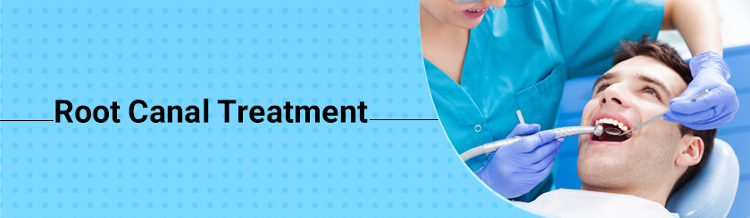 Root-Canal-Treatment