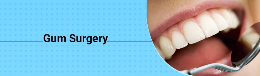 gum-surgery