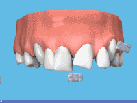 orthodontics